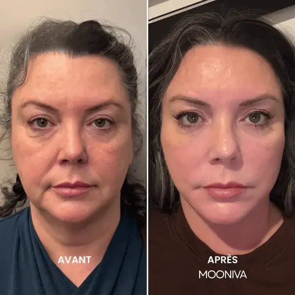 Témoignage 🇨🇭 Claudia – Lausanne